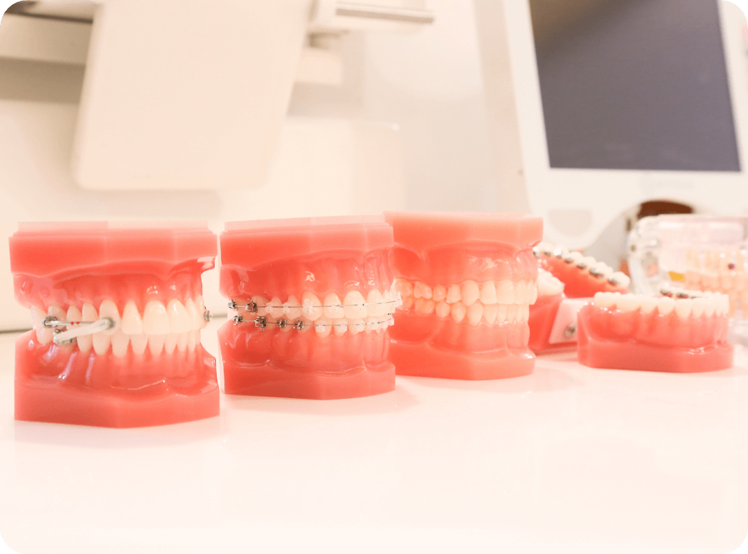 FEATURE 03適切な治療を行うため、複数の矯正装置の選択肢をご用意